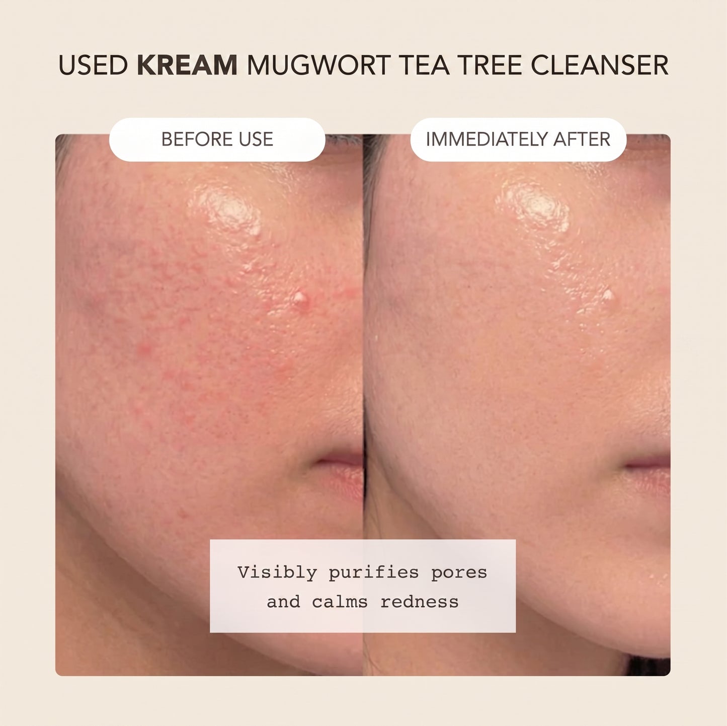 Face Mask Cleanser